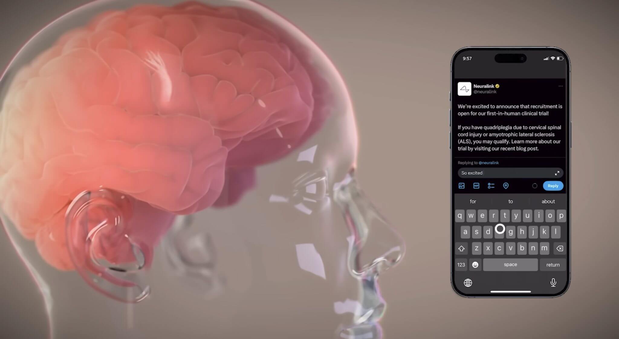 马斯克分享 Neuralink 首款人类设备—心灵感应（Telepathy）的总体细节